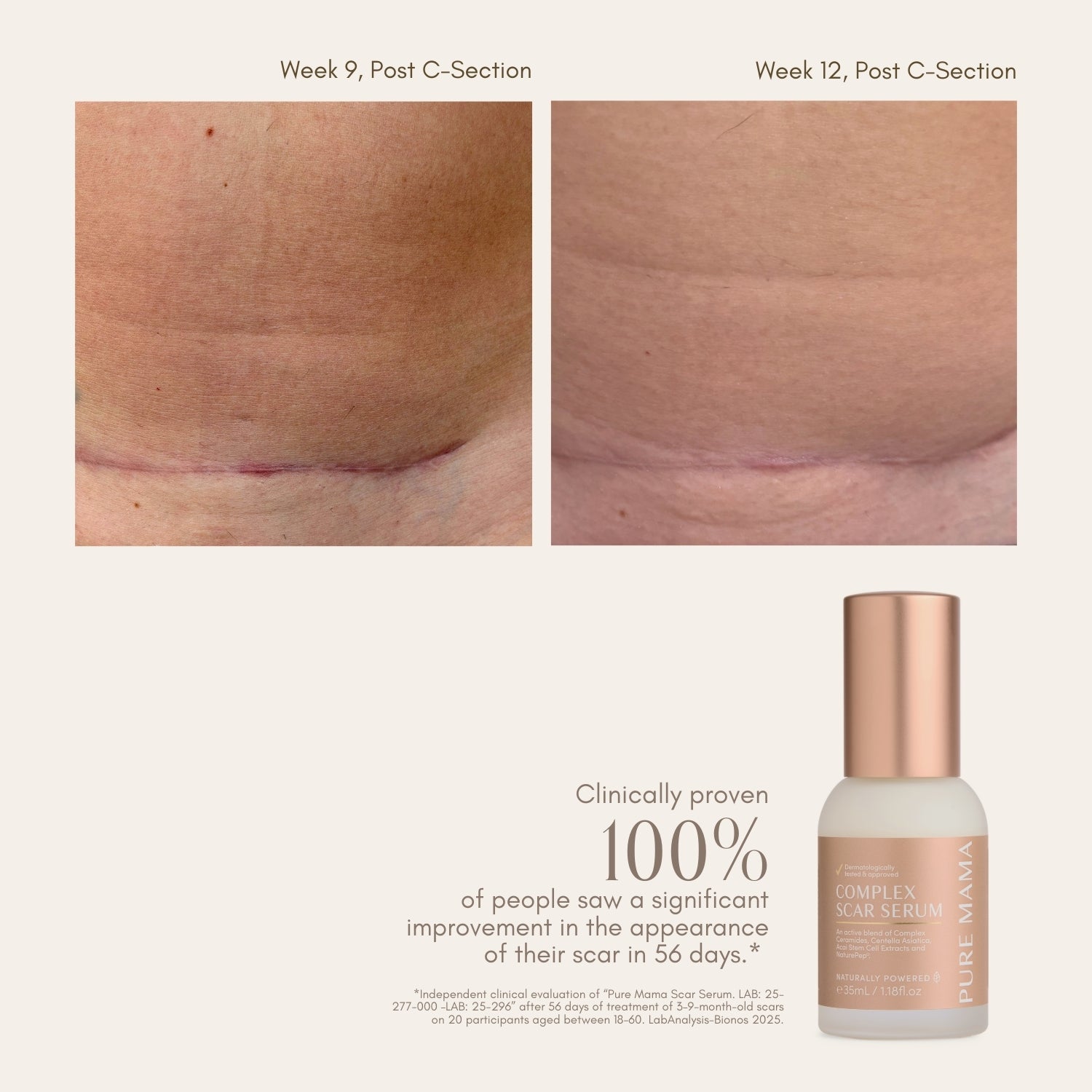 pure mama complex scar serum