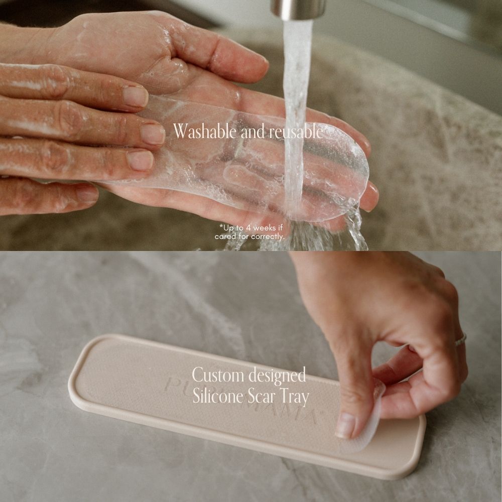 Pure Mama C-Section Scar Care Kit