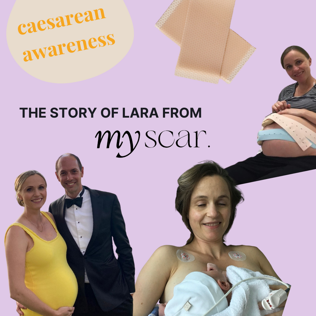 Caesarean Awareness Month - Q + A with myscar. Founder Lara Hofer.
