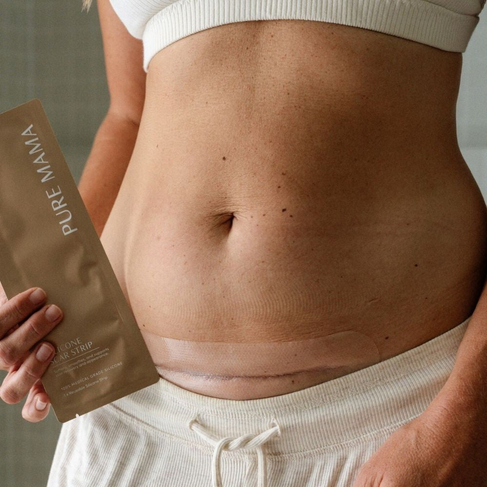 pure mama silicone scar strip