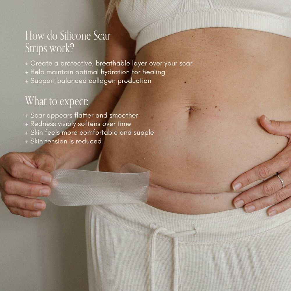 pure mama silicone scar strip