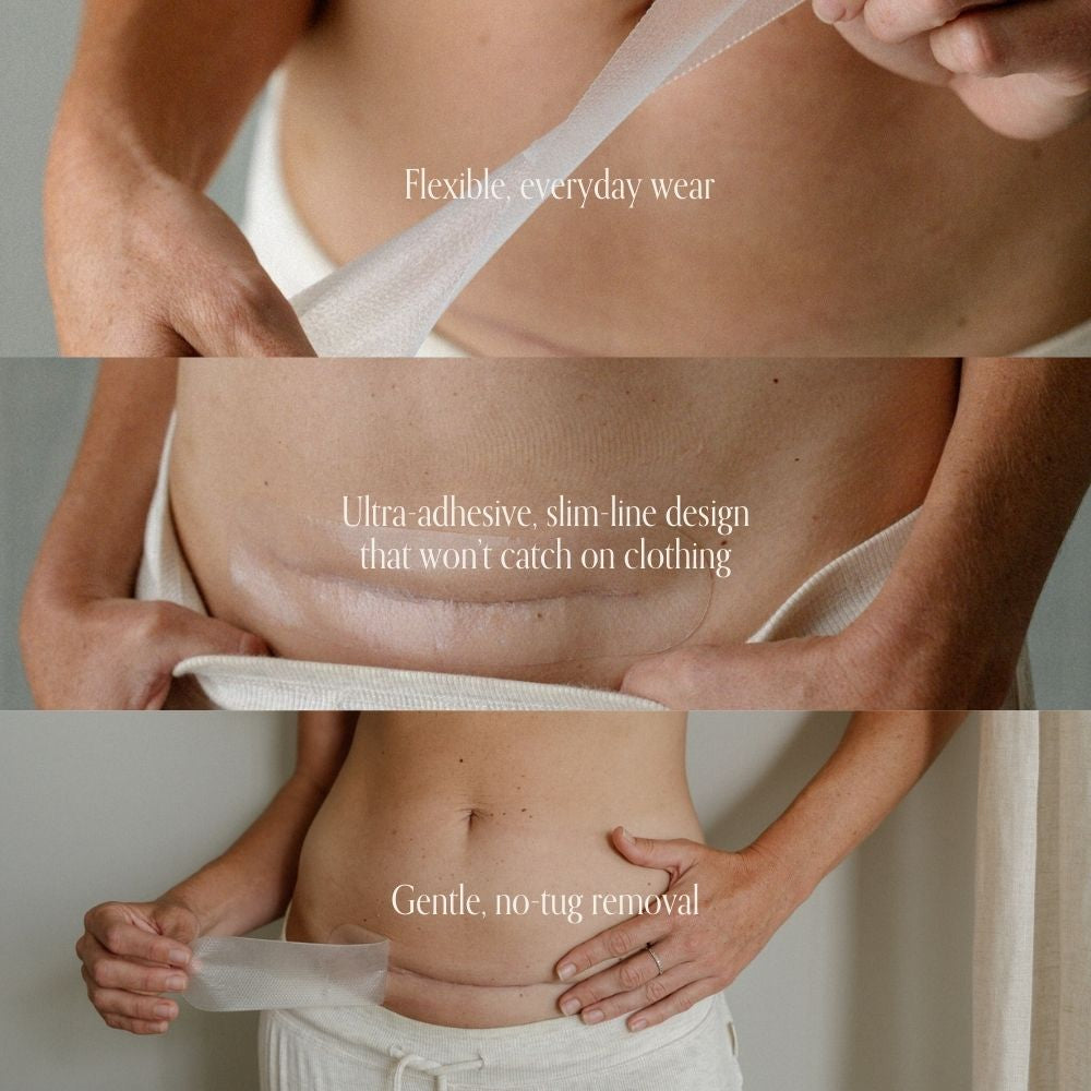 pure mama silicone scar strip