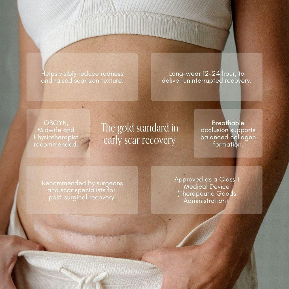 pure mama silicone scar strip